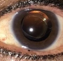 20 Happy 2020 happy patients